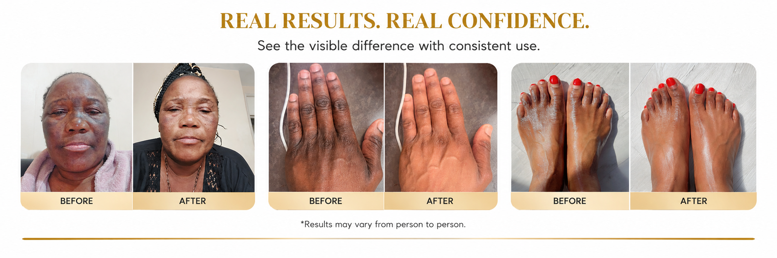 Before and after skincare results